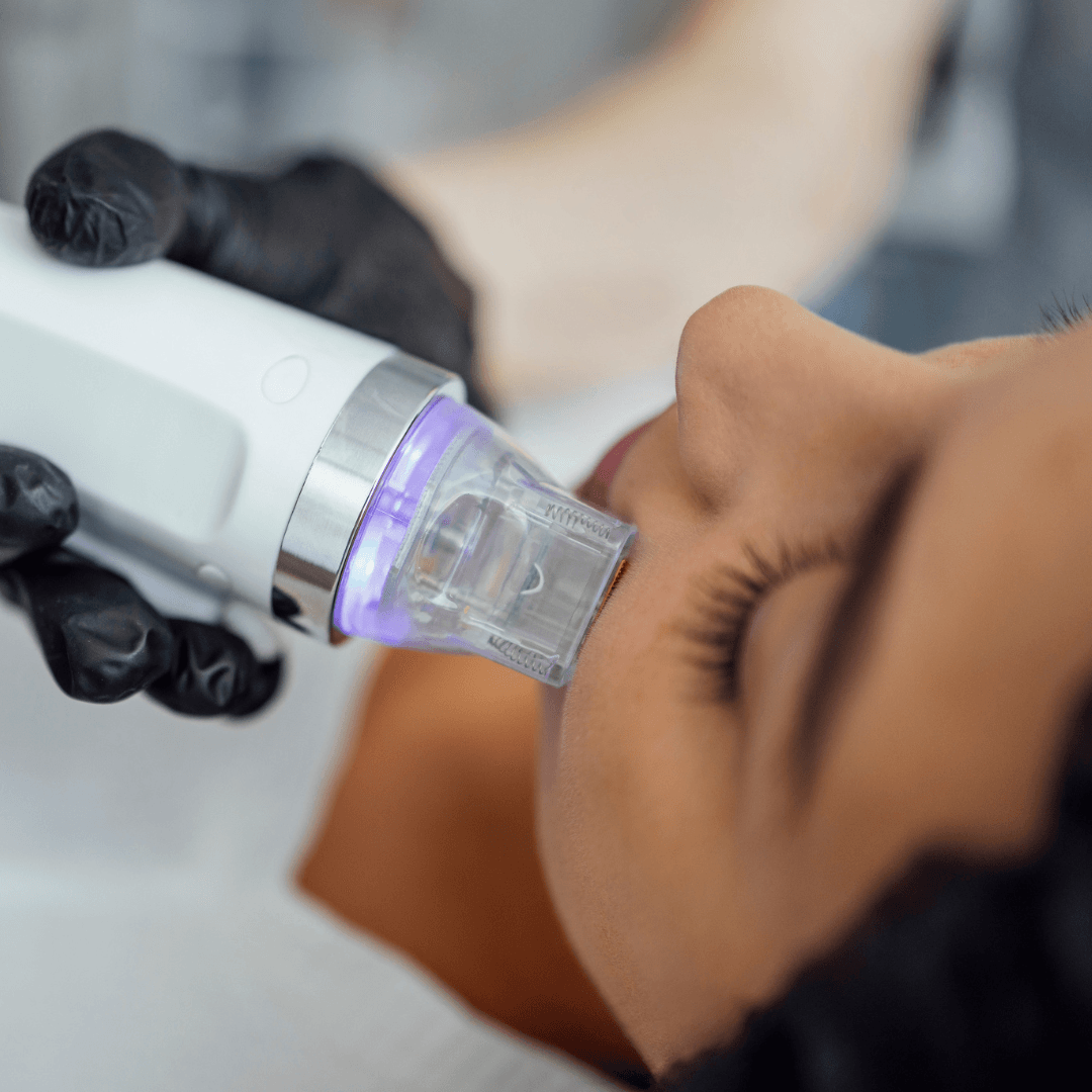Microneedling capacitación cursos